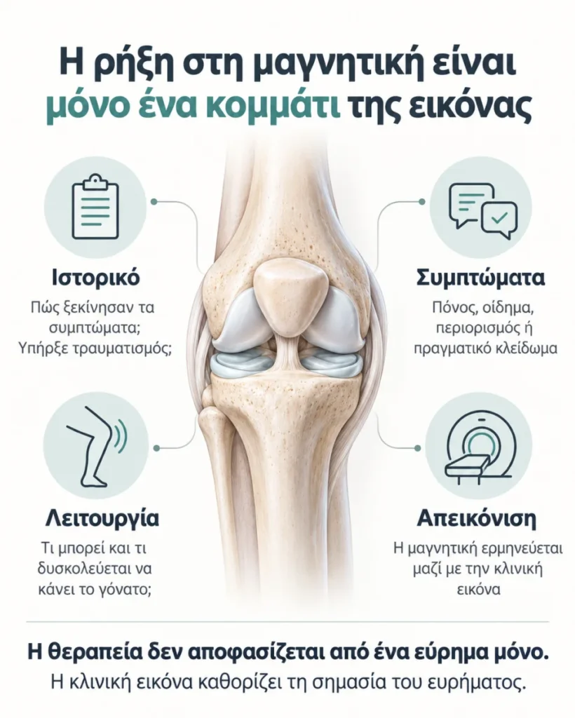 Infographic για τη ρήξη μηνίσκου που δείχνει ότι ιστορικό, συμπτώματα, λειτουργία και μαγνητική αξιολογούνται μαζί